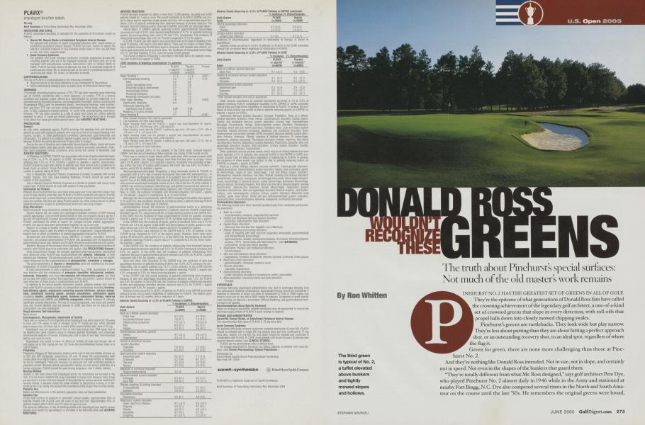 DONALD ROSS WOULDN'T RECOGNIZE THESE GREENS